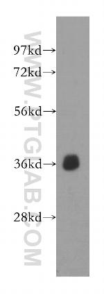 EIF2S1 Antibody in Western Blot (WB)