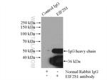 EIF2S1 Antibody in Immunoprecipitation (IP)