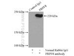 PRPF8 Antibody in Immunoprecipitation (IP)