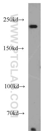 PRPF8 Antibody in Western Blot (WB)