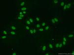 EAF2 Antibody in Immunocytochemistry (ICC/IF)