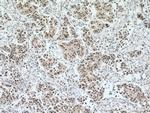 EAF2 Antibody in Immunohistochemistry (Paraffin) (IHC (P))