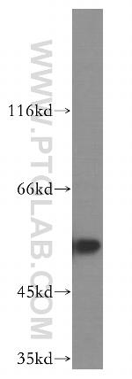 FKBP8 Antibody in Western Blot (WB)