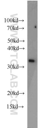 PSMA1 Antibody in Western Blot (WB)