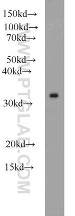 PSMA1 Antibody in Western Blot (WB)