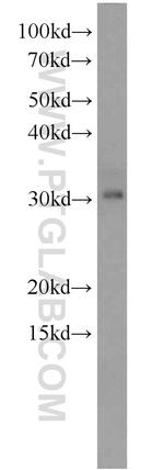 PSMA1 Antibody in Western Blot (WB)