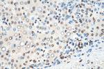 HNRNPA1 Antibody in Immunohistochemistry (Paraffin) (IHC (P))