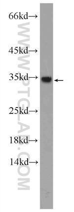 HNRNPA1 Antibody in Western Blot (WB)