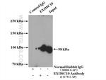 EXOSC10 Antibody in Immunoprecipitation (IP)