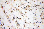 NUDT6 Antibody in Immunohistochemistry (Paraffin) (IHC (P))