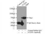 NUDT6 Antibody in Immunoprecipitation (IP)