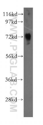 NUDT6 Antibody in Western Blot (WB)