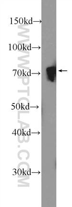 NUDT6 Antibody in Western Blot (WB)