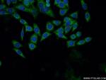 DHPS Antibody in Immunocytochemistry (ICC/IF)