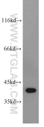 DHPS Antibody in Western Blot (WB)