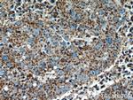 ALPL Antibody in Immunohistochemistry (Paraffin) (IHC (P))