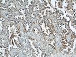 ALPL Antibody in Immunohistochemistry (Paraffin) (IHC (P))