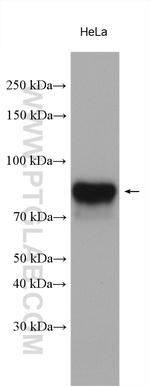 ALPL Antibody in Western Blot (WB)