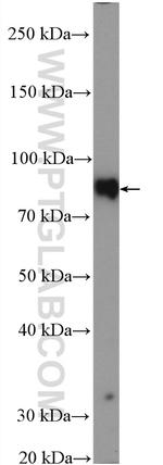 ALPL Antibody in Western Blot (WB)