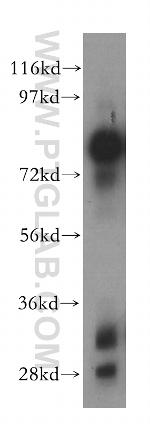 ALPL Antibody in Western Blot (WB)