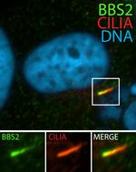 BBS2 Antibody in Immunocytochemistry (ICC/IF)