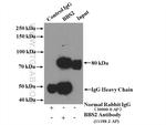 BBS2 Antibody in Immunoprecipitation (IP)