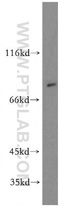 BBS2 Antibody in Western Blot (WB)