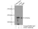 NEK9 Antibody in Immunoprecipitation (IP)