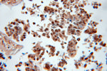 AKR1C3 Antibody in Immunohistochemistry (Paraffin) (IHC (P))