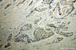 AKR1C3 Antibody in Immunohistochemistry (Paraffin) (IHC (P))