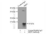 SRP9 Antibody in Immunoprecipitation (IP)