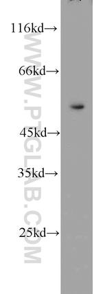 PSMC1 Antibody in Western Blot (WB)