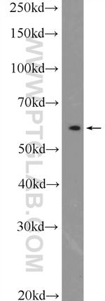 PSMC1 Antibody in Western Blot (WB)