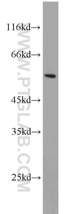 PSMC1 Antibody in Western Blot (WB)