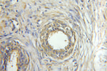 ORM2 Antibody in Immunohistochemistry (Paraffin) (IHC (P))