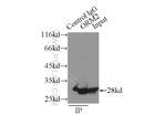 ORM2 Antibody in Immunoprecipitation (IP)