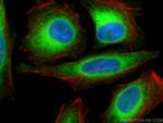 BAP31 Antibody in Immunocytochemistry (ICC/IF)