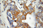 BAP31 Antibody in Immunohistochemistry (Paraffin) (IHC (P))