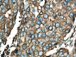 BAP31 Antibody in Immunohistochemistry (Paraffin) (IHC (P))