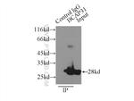 BAP31 Antibody in Immunoprecipitation (IP)