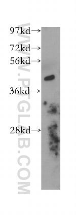 Actopaxin Antibody in Western Blot (WB)