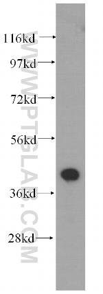 Actopaxin Antibody in Western Blot (WB)