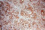 ENO1 Antibody in Immunohistochemistry (Paraffin) (IHC (P))