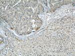 ENO1 Antibody in Immunohistochemistry (Paraffin) (IHC (P))