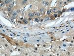 ENO1 Antibody in Immunohistochemistry (Paraffin) (IHC (P))