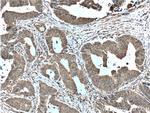 ENO1 Antibody in Immunohistochemistry (Paraffin) (IHC (P))