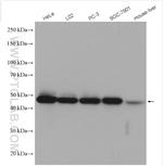 ENO1 Antibody in Western Blot (WB)