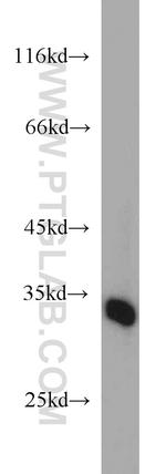 RSU1 Antibody in Western Blot (WB)