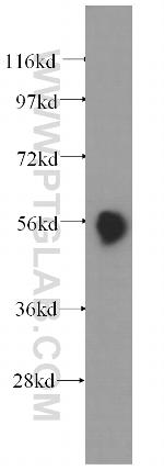 Pancreatic Lipase Antibody in Western Blot (WB)