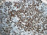 Pancreatic Lipase Antibody in Immunohistochemistry (Paraffin) (IHC (P))